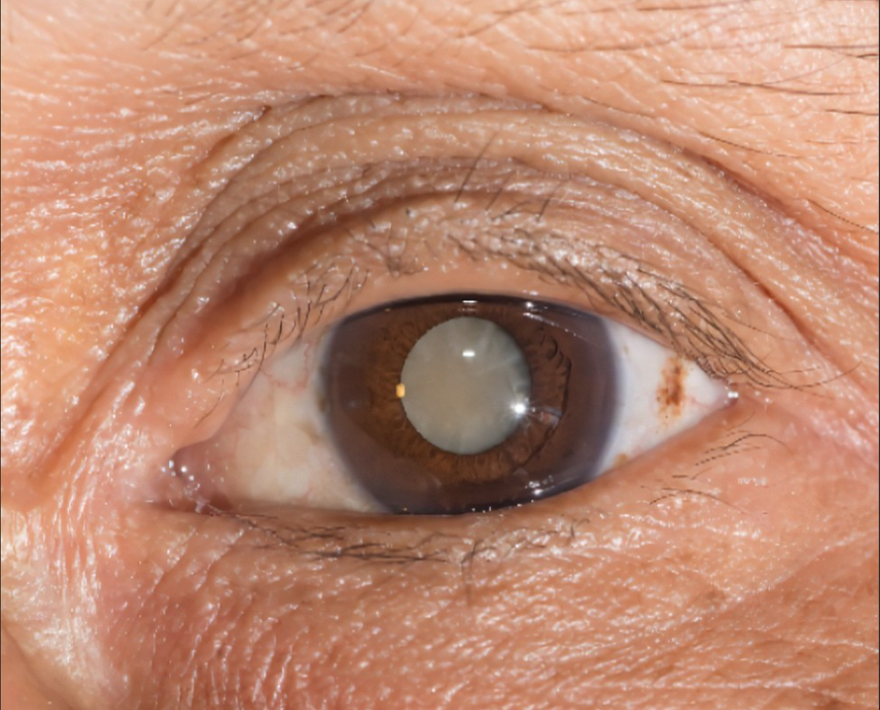 image-20220307172125859