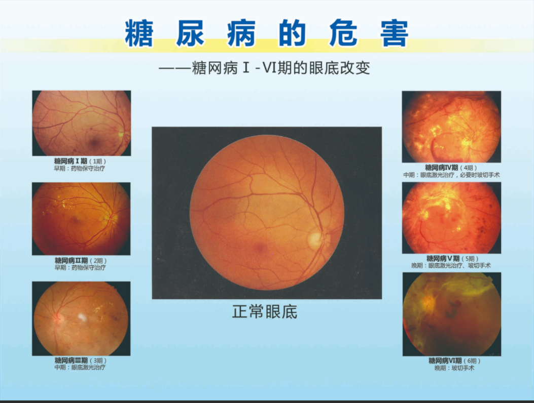 image-20220307172209556